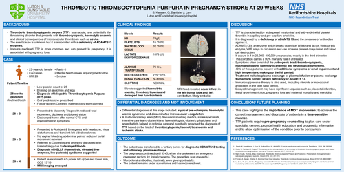 Preview of Thrombotic Thrombocytopenic Purpura in pregnancy: stroke at 29 weeks
