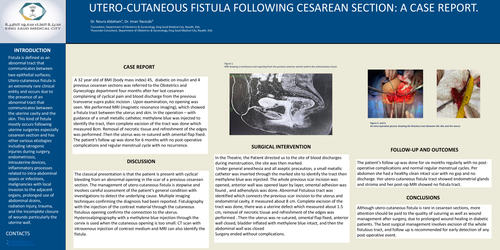 Preview of Utero-cutaneous fistula