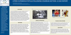 Thumbnail for Utero-cutaneous fistula