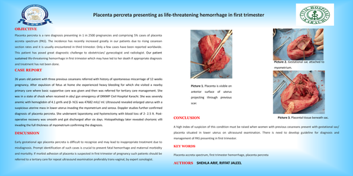Preview of Placenta percreta presenting as life-threatening hemorrhage in first trimester.