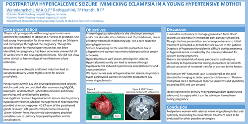 Preview of POSTPARTUM HYPERCALCEMIC SEIZURE MIMICKING ECLAMPSIA IN A YOUNG HYPERTENSIVE MOTHER