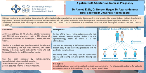 Preview of Stickler syndrome in Pregnancy