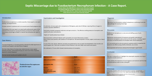 Preview of Septic Miscarriage due to Fusobacterium Necrophorum Infection - A Case Report.