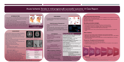 Thumbnail for Acute ischaemic stroke in mid pregnancy and successful outcome – a case report