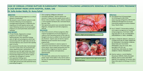 Preview of Cornual uterine rupture in subsequent pregnancy following laparoscopic removal of Cornual pregnancy