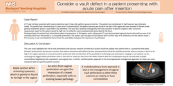 Thumbnail for Consider a vault defect with acute pain after pessary insertion