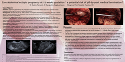 Thumbnail for Live abdominal ectopic pregnancy at 12 weeks gestation following no-scan medical abortion