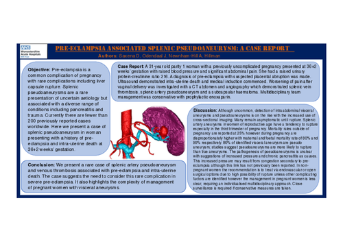 Preview of Pre-eclampsia associated splenic pseudoaneurysm: A case report