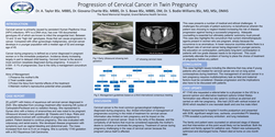 Thumbnail for Progression of Cervical Cancer in a Twin Pregnancy
