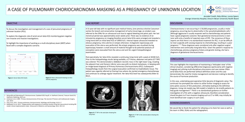 Preview of A Case of a Missing Pregnancy of Unknown Location