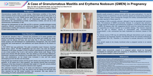 Preview of A Case of Granulomatous Mastitis and Erythema Nodosum (GMEN) in Pregnancy