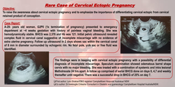 Thumbnail for Rare Case of Cervical Ectopic Pregnancy