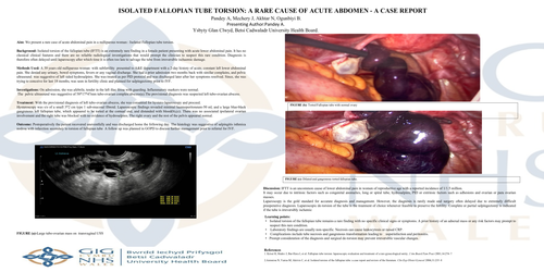 Preview of ISOLATED FALLOPIAN TUBE TORSION: A RARE CAUSE OF ACUTE ABDOMEN