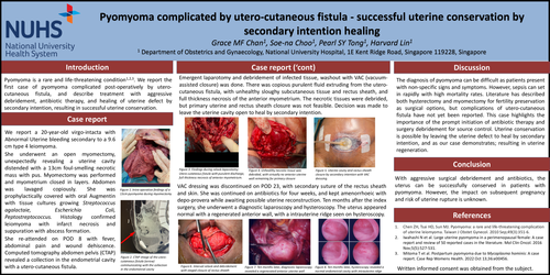 Preview of Pyomyoma complicated by utero-cutaneous fistula - successful uterine conservation by secondary intention healing