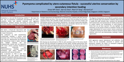 Thumbnail for Pyomyoma complicated by utero-cutaneous fistula - successful uterine conservation by secondary intention healing