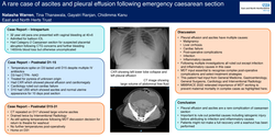 Thumbnail for A rare case of ascites and pleural effusion following emergency caesarean section