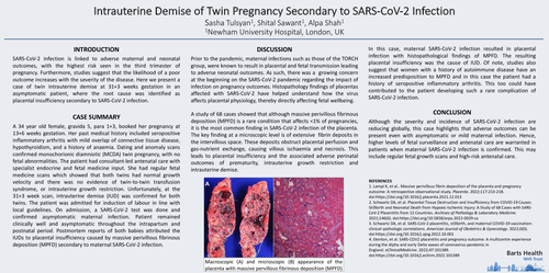 Preview of Intrauterine Demise of Twin Pregnancy Secondary to SARS-CoV-2 Infection