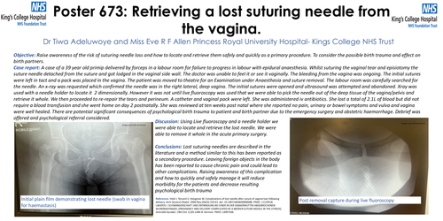 Preview of Retrieving a lost suturing needle from the vagina