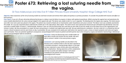Thumbnail for Retrieving a lost suturing needle from the vagina