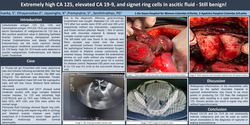 Thumbnail for Extremely high CA 125, elevated CA-19-9, and signet ring cells - Still benign!