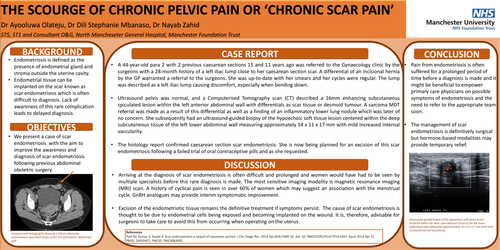 Preview of The scourge of chronic pelvic pain or chronic scar pain?