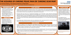 Thumbnail for The scourge of chronic pelvic pain or chronic scar pain?