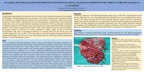 Preview of SUCCESFULL OUTCOME FOLLOWING DIAGNOSIS OF SUCCENTURIATE PLACENTA,VELAMENTOUS CORD INSERTION,VASA PRAEVIA.