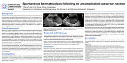 Thumbnail for Spontaneous haematocolpos following an uncomplicated caesarean section