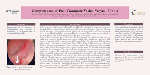 Preview of Complex case of Post Traumatic Vesico-Vaginal Fistula