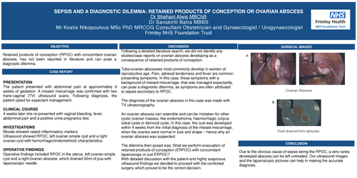 Preview of Sepsis and a Diagnostic Dilemma: Retained products of conception or ovarian abscess
