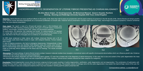 Preview of HAEMORRHAGIC CYSTIC DEGENERATION OF UTERINE FIBROID PRESENTING AS OVARIAN MALIGNANCY