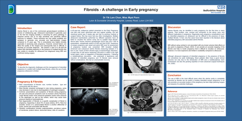 Preview of Fibroids - A challenge in Early pregnancy