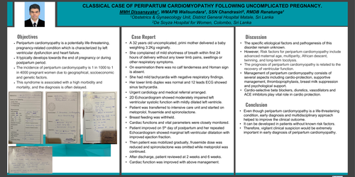 Preview of CLASSICAL CASE OF PERIPARTUM CARDIOMYOPATHY FOLLOWING UNCOMPLICATED PREGNANCY.