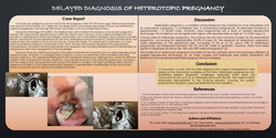 Thumbnail for A case of Heterotopic pregnancy - Lewisham and Greenwich Trust, London.