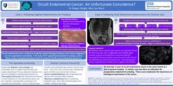 Thumbnail for Occult endometrial cancer: an unfortunate coincidence?