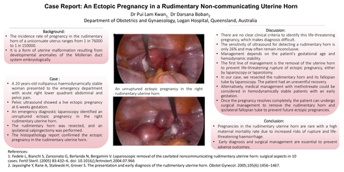 Preview of Case Report: An ectopic pregnancy in a rudimentary non-communicating uterine horn