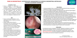 Thumbnail for 'BONE' IN ENDOMETRIUM! - Hysteroscopic management of osseous metaplasia presenting with secondary infertility.
