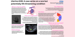 Thumbnail for Uterine AVM: A case series of a rare but potentially dangerous finding