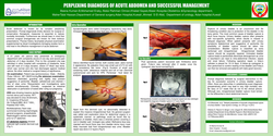 Thumbnail for PERPLEXING DIAGNOSIS OF ACUTE ABDOMEN AND SUCCESSFUL MANAGEMENT