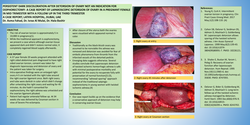 Thumbnail for Persistent dark discoloration after detorsion of ovary not an indication for oophorectomy