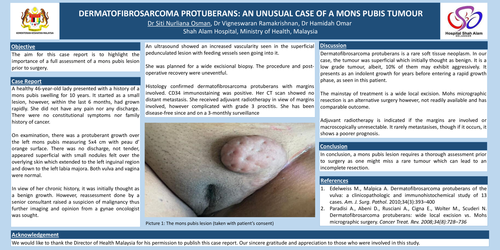 Preview of DERMATOFIBROSARCOMA PROTUBERANS: An unusual case of a mons pubis tumour