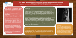 Thumbnail for Rare case of Cauda equina in pregnancy and diagnostic and management dilemmas.