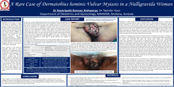Thumbnail for A rare case of Dermatobius hominis Vulvar Myiasis in a nulligravida woman