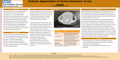 Preview of Hydropic degeneration of Uterine Leiomyoma-A case report