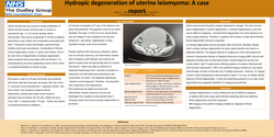 Thumbnail for Hydropic degeneration of Uterine Leiomyoma-A case report
