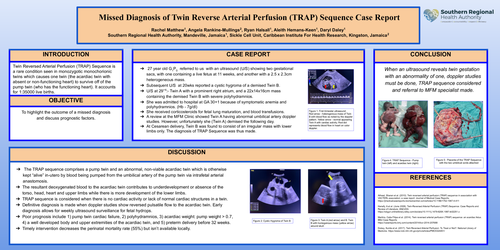 Preview of Missed diagnosis of Twin Reverse Arterial Perfusion (TRAP) Sequence