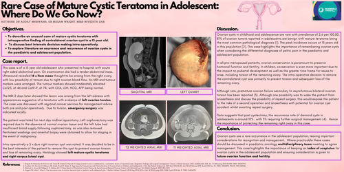 Preview of Bilateral ovarian cysts in adolescence: considerations for management