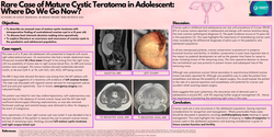 Thumbnail for Bilateral ovarian cysts in adolescence: considerations for management