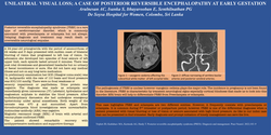 Thumbnail for Unilateral visual loss. A case of posterior reversible encephalopathy at early gestation.