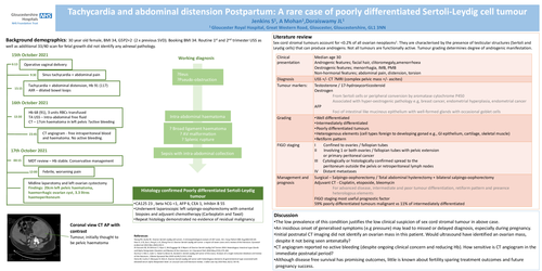 Preview of Postpartum tachycardia and abdominal distension: A case of poorly differentiated Sertoli-Leydig tumour